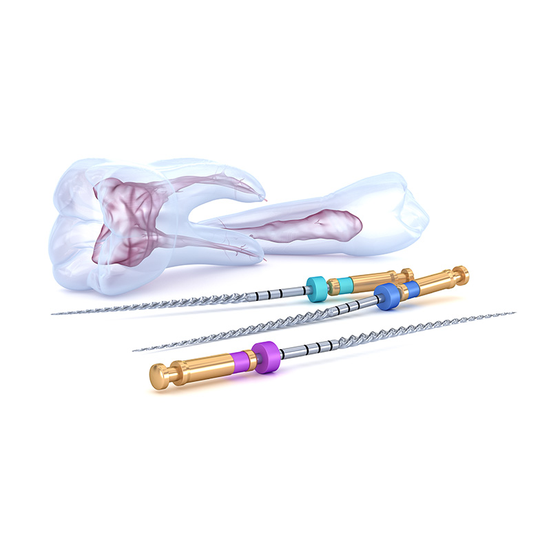 根管治療（歯内療法）