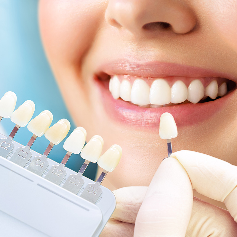 ホワイトニング